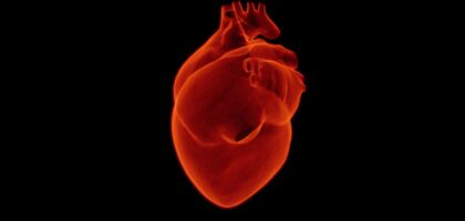 What is a Heart Attack?