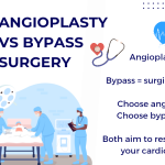 Angioplasty vs. Bypass Surgery: What’s the Difference?