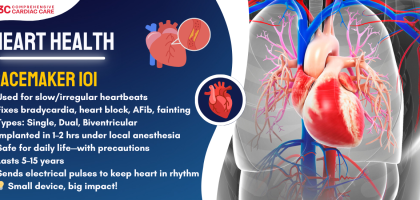 Pacemakers: When Are They Needed and How Do They Work?