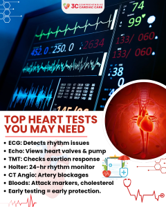 Top Cardiac Tests You Might Need
