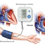 He Ignored His Blood Pressure
