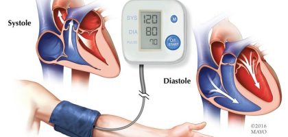 He Ignored His Blood Pressure for Years. Then One Morning