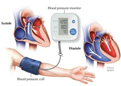 He Ignored His Blood Pressure